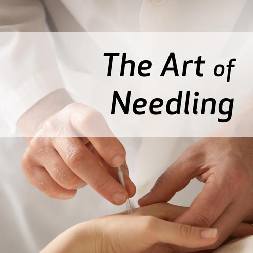The Art of Needling