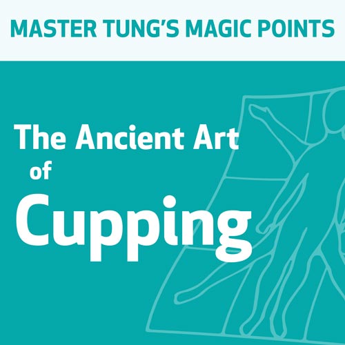 The Ancient Art of Cupping