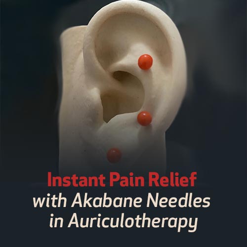 Instant Pain Relief with Akabane Needles in Auriculotherapy